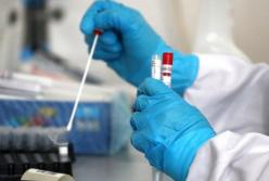 Ученые обнаружили нервные расстройства у трети переболевших COVID-19