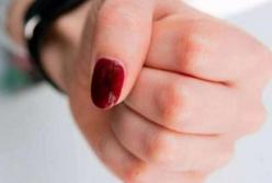 На Кировоградщине женщина до смерти избила бывшую свекровь 