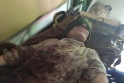 На линии разграничения в зоне ООС женщине оторвало ногу