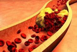 Врачи назвали продукт, который поможет очистить сосуды от холестерина