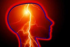 Медики назвали привычку, которая повышает риск возникновения инсульта