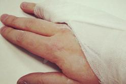 В Киеве пьяный мужчина сломал палец полицейскому