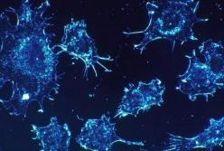 Ученые нашли вещество, которое замедляет рост раковых клеток
