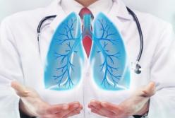Врачи рассказали об опасных симптомах рака легких 