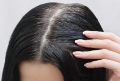Ученые назвали причины появления ранней седины