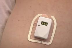 Никаких иголок: создан пластырь, который измеряет уровень сахара в крови