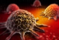 Врачи назвали вредные привычки, провоцирующие онкологию