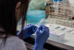 Медики объяснили, какие боли могут быть признаком высокого холестерина