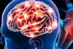 Медики рассказали, как распознать микроинсульт и предотвратить катастрофу мозга
