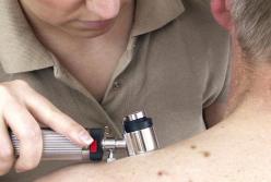 Специалисты назвали признаки рака, которые обычно не воспринимают всерьез