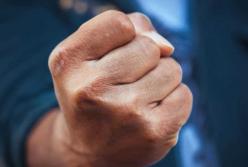 В Житомирской области мужчина после драки впал в кому и умер