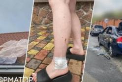 Жителі Київщини готують скаргу через небезпечне проведення виставки озброєння
