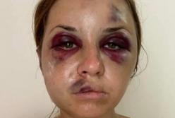 Избиение в поезде: сотрудники УЗ предлагали жертве взятку