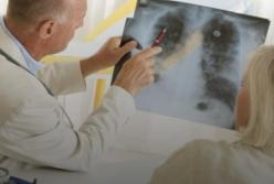 Медики рассказали, как уберечь себя от рака легких