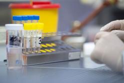 Украина ожидает тест-системы, которых хватит для исследования 5 тысяч образцов на коронавирус