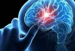 Ученые назвали привычку, повышающую риск инсульта