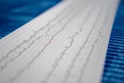 Медики обнаружили неожиданную причину инсультов