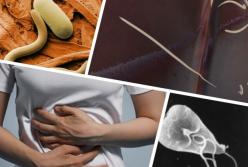 Названы симптомы заражения паразитами