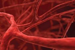 Медики назвали четыре привычки, которые наносят вред сосудам 