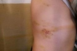 В Кропивницком СИЗО издевались над двумя задержанными (фото)