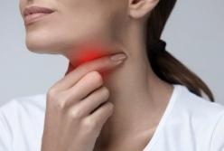 Как избавиться от боли в горле: эффективные методы