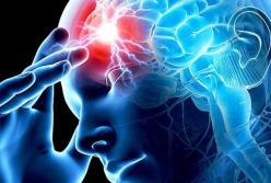 Ученые назвали симптомы, проявляющиеся за месяц до инсульта