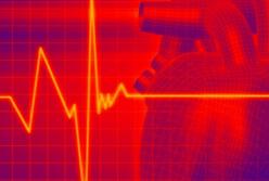 Врачи объяснили, как снизить пульс при тахикардии