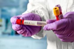 В Украине 835 новых заражений коронавирусом