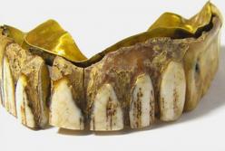 В Британии нашли 200-летнюю вставную челюсть из золота и кости (фото)