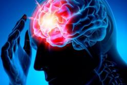 Медики назвали сигналы, предупреждающие об инсульте 