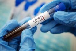 В Украине подтвердили еще более 3,5 тысячи новых случаев COVID-19