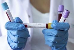 В Украине подтвердили еще 6813 новых случаев COVID