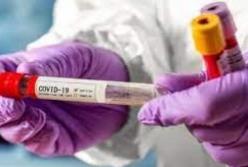 В Украине 696 новых случаев коронавируса