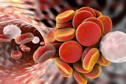 Врачи рассказали о симптомах образования тромба