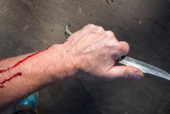 В Харькове мужчина в припадке ревности ударил жену ножом (фото)