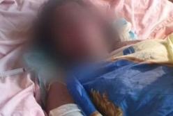 В Кривом Роге умерла беременная женщина, которую поджег 17-летний сожитель