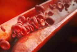 Медики назвали первые симптомы повышенного холестерина