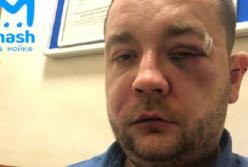 Головой об капот: в России таксист жестоко расправился с пассажиром