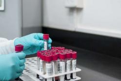 Медики назвали группу крови, обладатели которой реже всего болеют раком