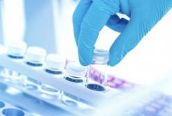 В Украине 244 новых случаев коронавируса