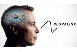 Ілон Маск чіпує людину в прямому ефірі: Neuralink вживлять у мозок пацієнта