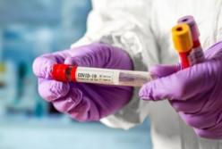 В Украине обнаружено уже более 74,2 тыс. случаев COVID-19, за сутки - 1061