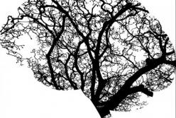 Врач назвал главные симптомы опухоли головного мозга