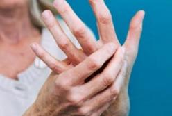 Ученые назвали лучшие домашние средства для лечения артрита