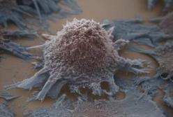 Ученые убили рак голодом