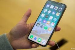 Ученые обнаружили новую опасность смартфонов для здоровья