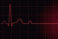 Ученые выявили причину внезапной остановки сердца у здоровых людей