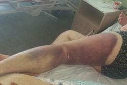 В Николаеве полицейских подозревают в пытках (фото, видео)