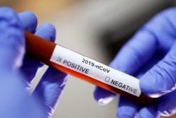 В Японии разработали быстрый тест на COVID-19