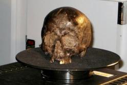 Ученые рассказали, как мог сохраниться один из старейших мозгов человека